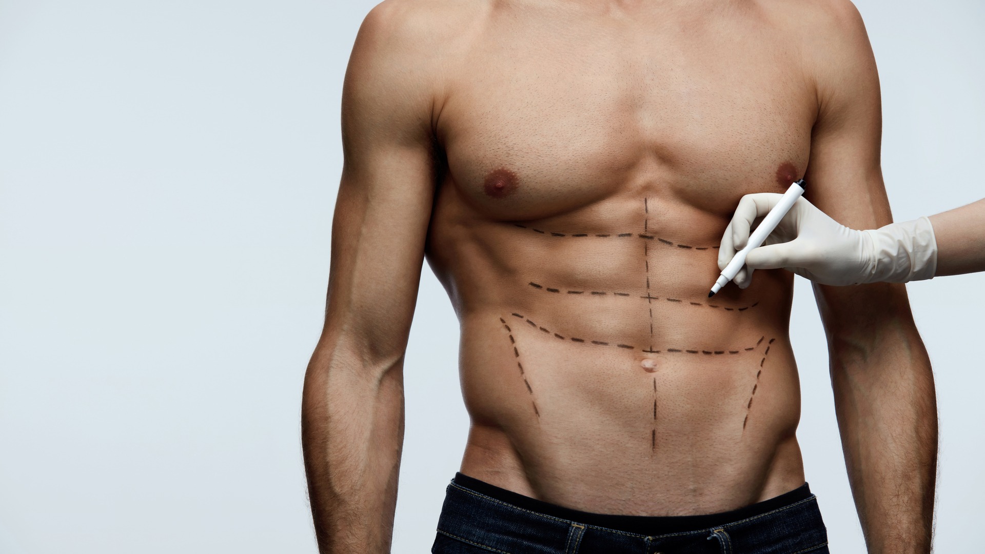 Мужская пластика: как выполняется торсопластика у мужчин после большой потери веса